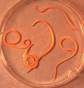 Parasites of the ascaride man