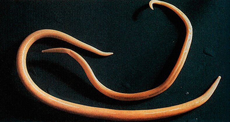 parasitic worm from the human body